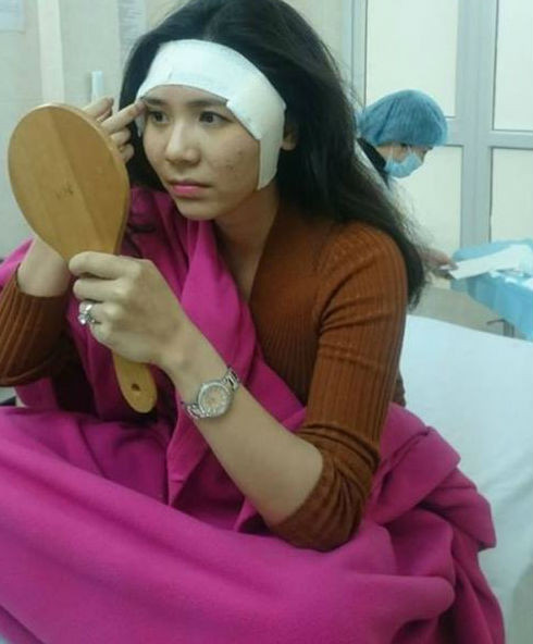 Mới đây loạt ảnh quá khứ của nàng Vân Điệp Người phán xử bị tung lên mạng xã hội. Trong những bức hình, nữ diễn viên Thanh Bi để lộ gương mặt được băng bó quanh vùng trán. Bên cạnh đó là các tấm ảnh hot girl này nằm trên giường phẫu thuật và được bác sỹ tư vấn sắc đẹp.