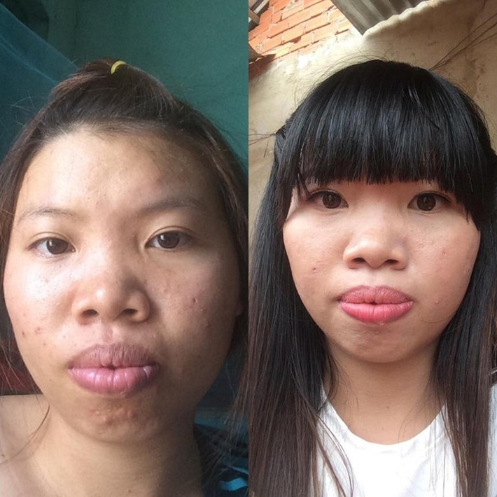 Quách Phượng hay còn được biết đến với cái tên Phượng "Thị Nở" từng gây xôn xao cư dân mạng một thời. Cô nàng 1996 này từng khiến netizen ngỡ ngàng bởi sự thay đổi nhan sắc đầy kì tích.