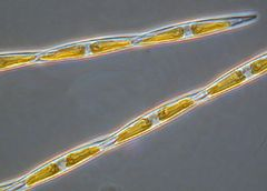 Axit domoic là một chất độc thần kinh có thể tích tụ trong động vật có vỏ, cá mòi và cá cơm, những loài ăn chủ yếu là tảo biển. Khi con người tiêu thụ hải sản chứa axit domoic, có thể dẫn đến những hậu quả nghiêm trọng như nôn mửa, tiêu chảy và mất trí nhớ. (Ảnh: Wikipedia)