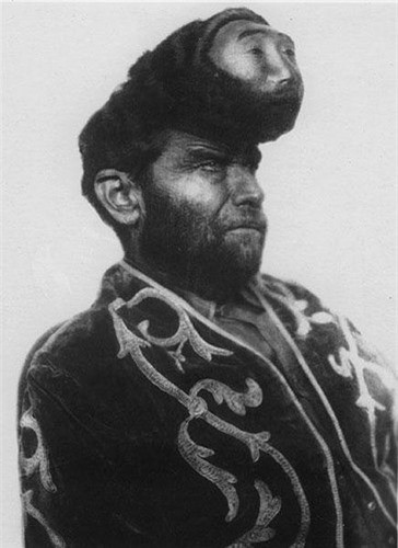 Pasqual Pinon, được gọi là "Người Mexico hai đầu".