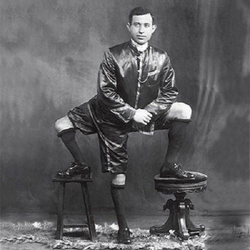 Trong số những người sinh ra với bộ phận dư thừa, ông George vốn nổi tiếng là người đàn ông có 3 chân. Sinh ra vào năm 1840, ông làm việc trong một rạp xiếc và tham gia vào nhiều chương trình kỳ lạ. Thế nhưng hiếm ai tin rằng ông có tới 2 trái tim. Sự thật này chỉ được chứng thực bởi các bác sĩ phẫu thuật sau khi ông George qua đời vì bệnh lao năm 1906.