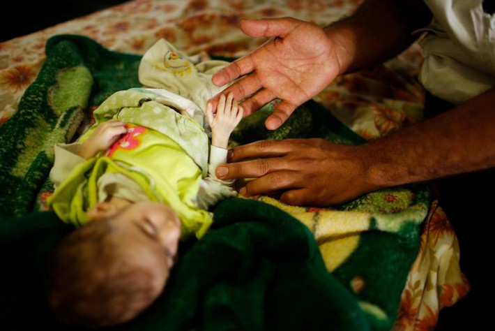Y tá xòe tay nắm bàn tay của một trẻ em Mosul mới 6 tháng tuổi tại một bệnh viện do tổ chức tình nguyện Medecins Sans Frontieres điều hành ở Qayyara, Iraq.