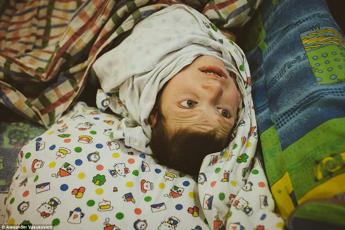 Sau khi điều tra, các công tố viên cho biết, hai giám đốc trại mồ côi bỏ bê trách nhiệm đã bị sa thải và khẳng định rằng, tình trạng bất thường của các em đã được các bác sĩ kiểm tra và kết luận. (Nguồn ảnh Daily Mail)