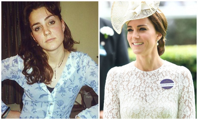 Kate Catherine, nữ Công Tước của Cambridge và là vợ của Hoàng tử William có vẻ ngoài "trẻ mãi không già" khi trông cô năm 18 tuổi và bây giờ ở tuổi 34 không khác nhau là mấy.