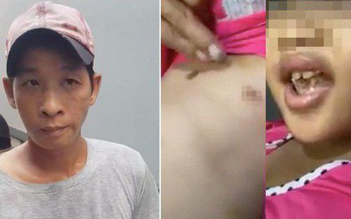 2. Cha dượng hờ châm thuốc lá vào bé gái: TAND quận 12 (TP.HCM) vừa tuyên phạt Hà Quốc Việt (37 tuổi) 8 năm tù. Việt khai do nghiện ma túy nên không kiểm soát được hành vi, đã đấm đá, dùng khúc gỗ đánh bầm tím người bé C. (6 tuổi, con riêng của người tình sống chung như vợ chồng) nhằm dọa bé. Cáo trạng nêu Việt còn châm thuốc lá vào bụng, nách, bộ phận sinh dục cháu bé nhưng sau đó đã chối do tự ngã. Người tố cáo là ông ngoại, người nuôi cháu nhiều năm nay.