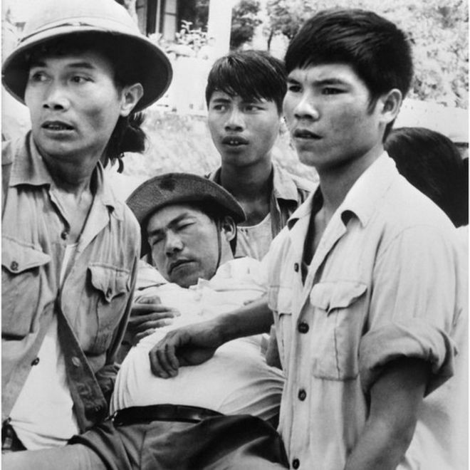Một phóng viên của ta bị thương trong quá trình tham gia tác nghiệp đang được đồng đội đưa về tuyến sau. Nguồn ảnh: Gettyimg.
