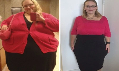 Tốc độ giảm cân không thể tin nổi của những người béo phì