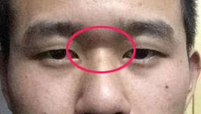 Người có bốn tướng mạo này cả đời sẽ nghèo khó Nguoi co bon tuong mao nay ca doi se ngheo kho