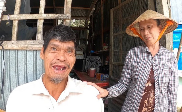 Cuộc sống của người đàn ông 'khổng lồ' cao gần 2m2, nặng 100kg Cuoc song cua nguoi dan ong 'khong lo' cao gan 2m2, nang 100kg