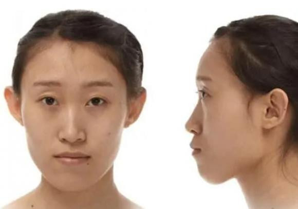 Sở hữu 4 kiểu khuôn mặt này, cả đời nghèo khó, tài vận kém sắc - Hình 4 So huu 4 kieu khuon mat nay, ca doi ngheo kho, tai van kem sac-Hinh-4