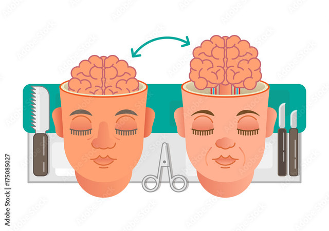 Ghép toàn bộ não người có khả thi, bất tử? - Hình 8 Ghep toan bo nao nguoi co kha thi, bat tu?-Hinh-8