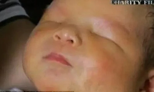 Bố mẹ sốc khi con trai sinh ra không có mắt