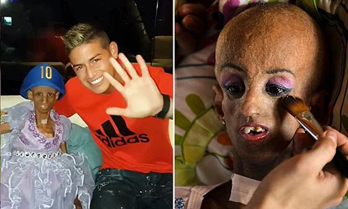 Cô bé có vẻ ngoài như cụ 90 tuổi được gặp thần tượng