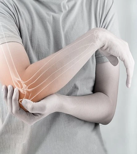 Những việc cần làm ngay khi gãy xương để xương mau lành