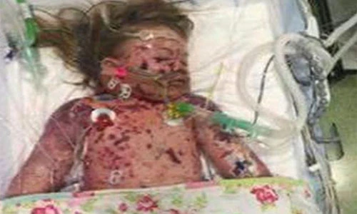 Thương tâm bé gái qua đời đúng ngày Valentine vì viêm màng não