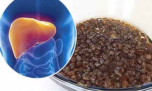 Thải độc gan bằng nho khô theo phương pháp truyền thống của Nga