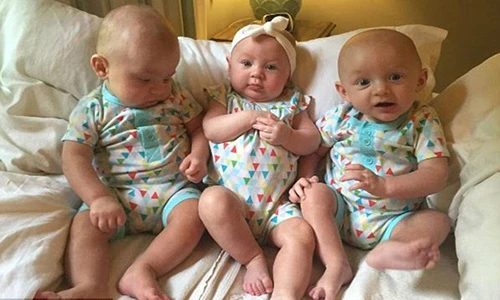 Kỷ lục ca sinh ba nặng thứ nhì thế giới 