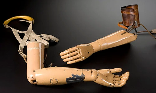 Sởn gai ốc các dụng cụ y tế thô sơ thời thế chiến 