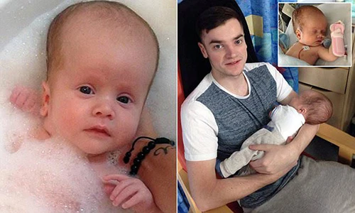 Bé sơ sinh đầu to quá khổ vì dị tật não