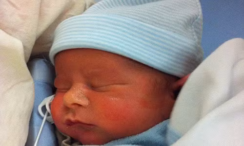 Gặp em bé đầu tiên được mổ tim khi còn trong bụng mẹ