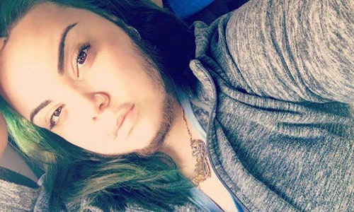 Thủ phạm khiến quý cô "chuẩn men" với bộ râu quai nón 