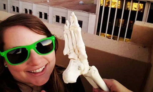 Cảm phục cô gái ung thư cụt chân đi khắp thế giới