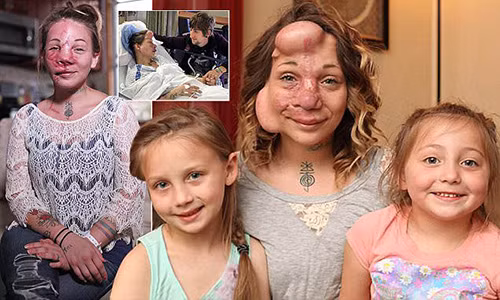 Hy hữu bà mẹ sống sót nhờ cấy túi nước biển vào mặt