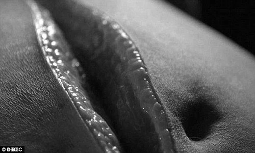 Quy trình khám nghiệm tử thi bệnh nhân béo phì chết vì suy tim