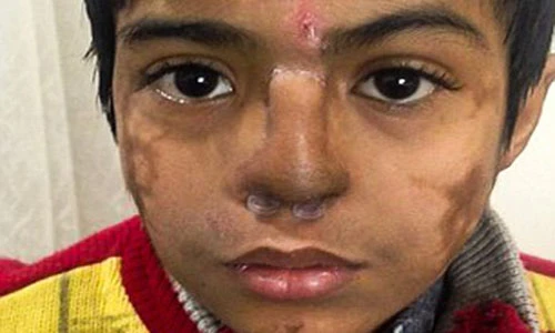 Cậu bé mũi chạy lên trán do gặp phải “lang băm“