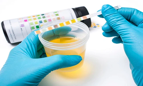 Thực hư uống nước tiểu thải độc tố, chữa bách bệnh?