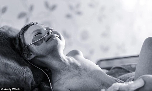 Bộ ảnh cảm động bố chụp con gái ung thư giai đoạn cuối