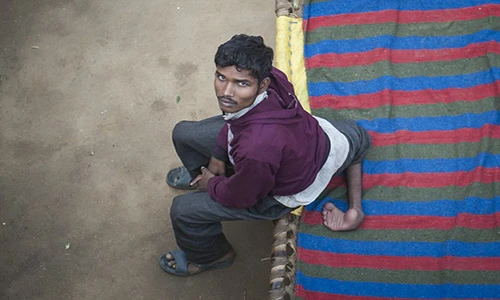 Hy hữu người 4 chân khẩn cầu bác sĩ cắt bớt 2 chân