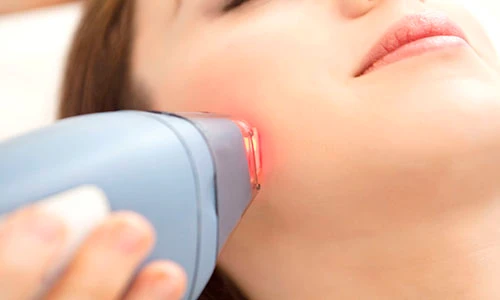 Triệt lông bằng laser tăng nguy cơ ung thư?