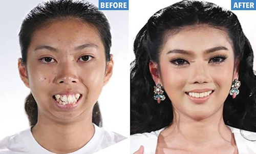 Giật mình hình ảnh trước dao kéo của hotgirl Thái Lan