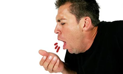 Nhìn màu sắc đờm dãi đoán bệnh tật nan y