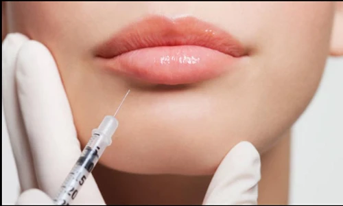 Cách để có môi dày tự nhiên theo xu hướng hiện nay