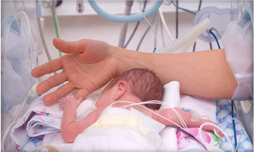3 nguy cơ sinh non hoàn toàn có thể phòng tránh