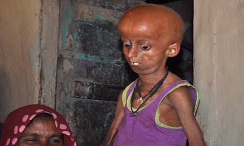 Xót xa thanh niên đôi mươi trong hình ảnh cụ già trăm tuổi