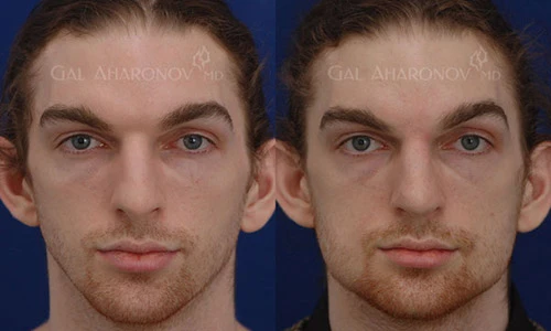 Những bộ phận nào nam giới chịu bỏ tiền đi thẩm mỹ