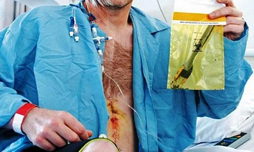 Hoảng hồn những thứ kinh dị nằm trong cơ thể con người