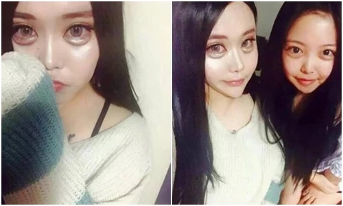 Mỹ nhân biến thành quái nhân vì tạo bọng mắt Hàn Quốc