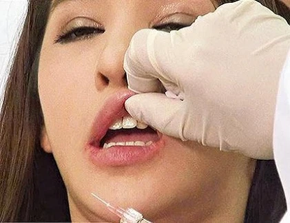 Cận cảnh kỹ thuật bơm môi, cấy mỡ làm đẹp