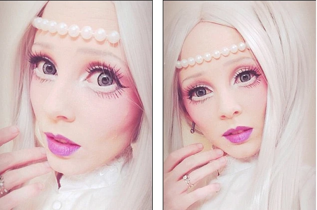 Căn bệnh hiểm biến thiếu nữ thành búp bê sống xinh đẹp