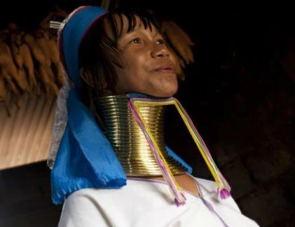 Quái chiêu kéo dài cổ đeo vòng làm đẹp