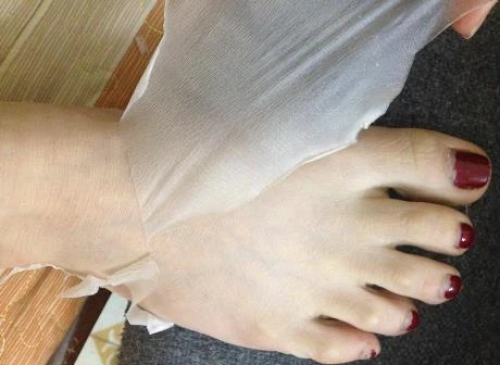 Nguy hiểm chết người từ tắm trắng da 