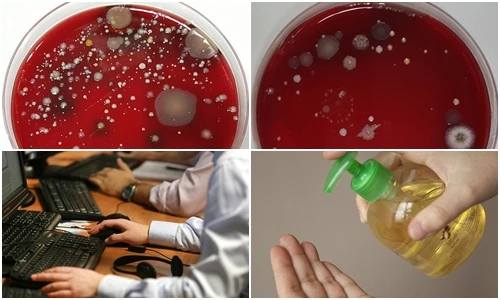 Ảnh dựng tóc gáy về vi khuẩn gây bệnh trong phòng làm việc