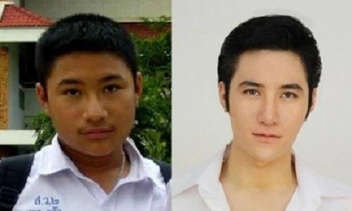 Hotboy người Thái "lột xác" hoàn toàn sau dao kéo