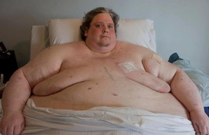 Người đàn ông béo nhất thế giới qua đời ở tuổi 44
