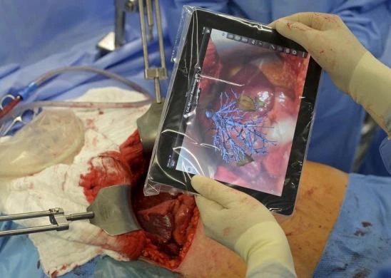 Cận cảnh một ca phẫu thuật gan bằng... máy tính bảng
