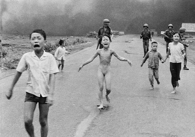 Hành trình chữa bỏng đau đớn của “em bé Napalm” Kim Phúc